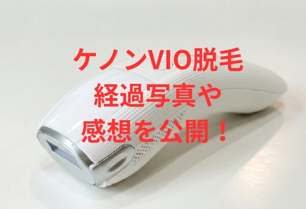 ケノンVIO脱毛の経過写真やビフォーアフター