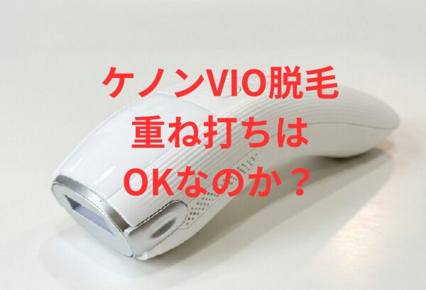 ケノンVIO重ね打ちはOK？